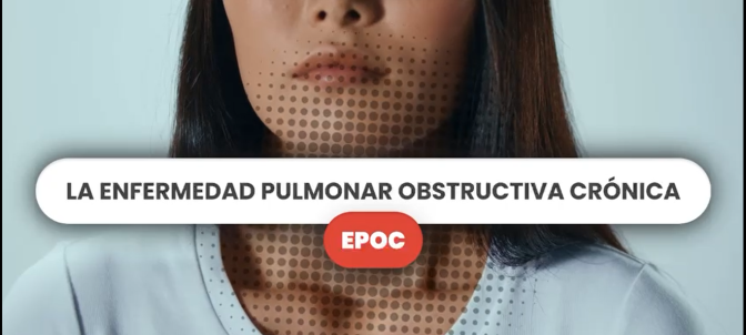 ENFERMEDAD PULMONAR OBSTRUCTIVA CRÓNICA - EPOC