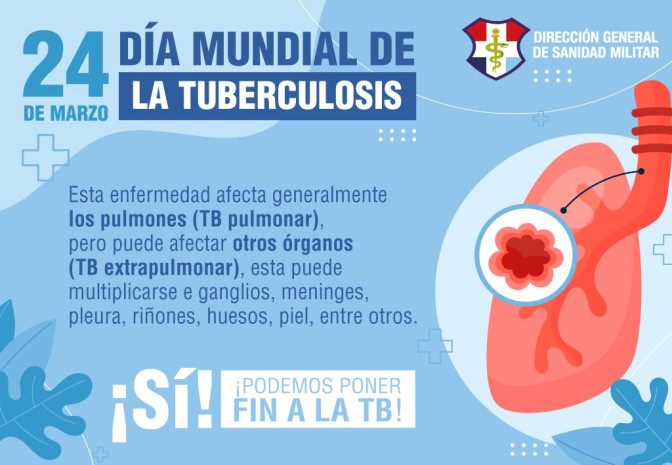 TUBERCULOSIS